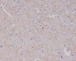 Anti-Amyloid beta A4 APP Rabbit Monoclonal Antibody